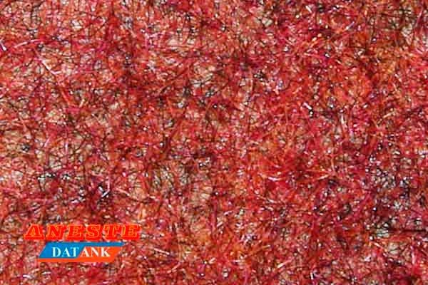 Césped marrón oxido